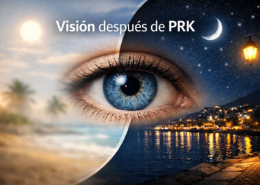 Recuperación Visual Tras Cirugía Prk